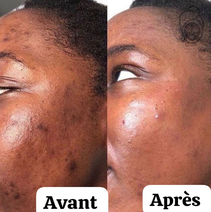 Kit curcuma (3 en 1) : Boite Coton curcuma + Sérum au curcuma + Masque au curcuma
